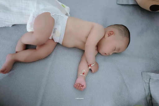 娄底六个月宝宝眼睛散光